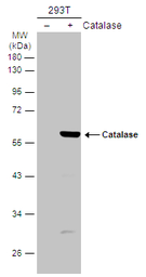 Anti-Catalase antibody used in Western Blot (WB). GTX110704