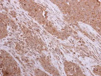 Anti-CKII alpha antibody [N1C3] used in IHC (Paraffin sections) (IHC-P). GTX110726