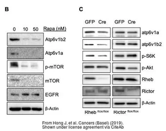 Anti-ATP6V1B2 antibody used in Western Blot (WB). GTX110783