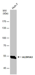 Anti-ALDH1A3 antibody [N2C2], Internal used in Western Blot (WB). GTX110784