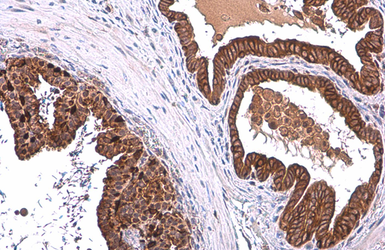Anti-ALDH1A3 antibody [N2C2], Internal used in IHC (Paraffin sections) (IHC-P). GTX110784