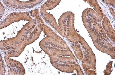 Anti-ALDH1A3 antibody [N2C2], Internal used in IHC (Paraffin sections) (IHC-P). GTX110784