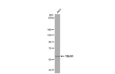 Anti-TBLR1 antibody [N3C3] used in Western Blot (WB). GTX110785