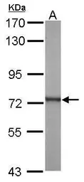 Anti-ATP6V1A antibody used in Western Blot (WB). GTX110815
