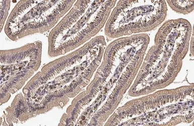 Anti-CYFIP2 antibody [N2C1], Internal used in IHC (Paraffin sections) (IHC-P). GTX110897