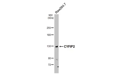 Anti-CYFIP2 antibody [N2C1], Internal used in Western Blot (WB). GTX110897