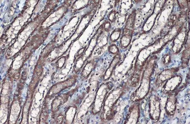 Anti-SLC25A6 antibody used in IHC (Paraffin sections) (IHC-P). GTX110983
