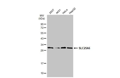 Anti-SLC25A6 antibody used in Western Blot (WB). GTX110983