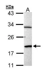 Anti-BCL2L15 antibody used in Western Blot (WB). GTX110988