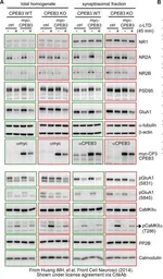 Anti-Calcineurin A antibody used in Western Blot (WB). GTX111039