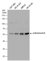 Anti-Calcineurin A antibody used in Western Blot (WB). GTX111039