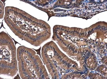 Anti-PI3 kinase p85 alpha antibody [N2C1], Internal used in IHC (Paraffin sections) (IHC-P). GTX111068
