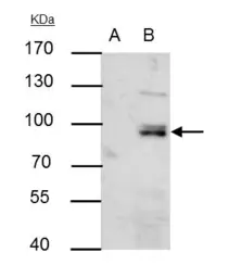 Anti-PI3 kinase p85 alpha antibody [N2C1], Internal used in Immunoprecipitation (IP). GTX111068