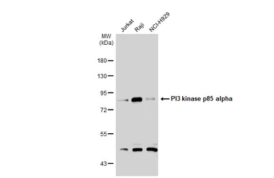 Anti-PI3 kinase p85 alpha antibody [N2C1], Internal used in Western Blot (WB). GTX111068