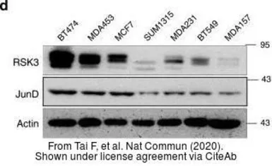 Anti-RSK3 antibody [N2C1], Internal used in Western Blot (WB). GTX111071