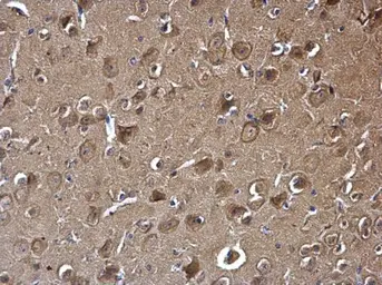 Anti-PAK1 antibody [N2C2], Internal used in IHC (Paraffin sections) (IHC-P). GTX111076