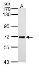 Anti-PPIL2 antibody used in Western Blot (WB). GTX111086