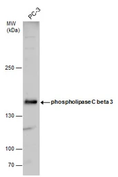 Anti-PLCB3 antibody used in Western Blot (WB). GTX111100