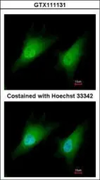 Anti-SMAD2 antibody used in Immunocytochemistry/ Immunofluorescence (ICC/IF). GTX111131