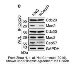 Anti-CDC20 antibody used in Western Blot and Immunoprecipitation (WB IP). GTX111137