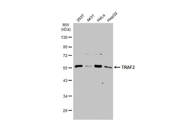 Anti-TRAF2 antibody used in Western Blot (WB). GTX111138
