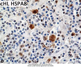 Anti-HSC70 antibody [C1C3] used in IHC (Paraffin sections) (IHC-P). GTX111150