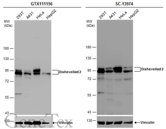 Anti-Dishevelled 2 antibody [N1N3] used in Western Blot (WB). GTX111156