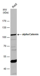 Anti-alpha Catenin antibody [N1N3] used in Western Blot (WB). GTX111168