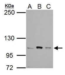 Anti-alpha Catenin antibody [N1N3] used in Western Blot (WB). GTX111168