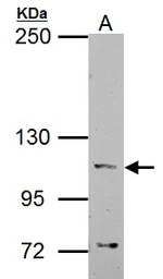 Anti-alpha Catenin antibody [N1N3] used in Western Blot (WB). GTX111168