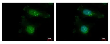 Anti-TAOK2 antibody [N1N2-2], N-term used in Immunocytochemistry/ Immunofluorescence (ICC/IF). GTX111171