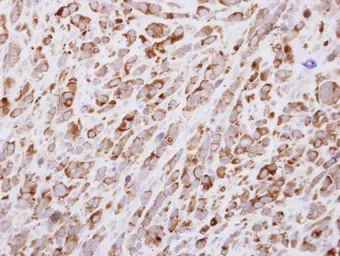 Anti-EGF antibody [C2C3], C-term used in IHC (Paraffin sections) (IHC-P). GTX111176