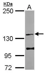 Anti-EGF antibody [C2C3], C-term used in Western Blot (WB). GTX111176