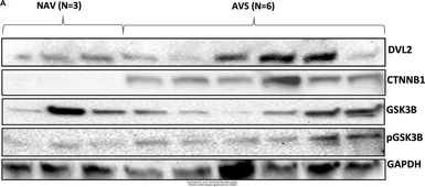 Anti-GSK3 beta antibody [C1C3] used in Western Blot (WB). GTX111192