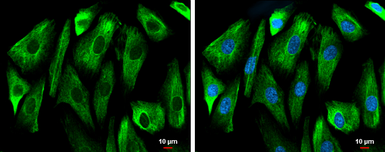 Anti-GSK3 beta antibody [C1C3] used in Immunocytochemistry/ Immunofluorescence (ICC/IF). GTX111192
