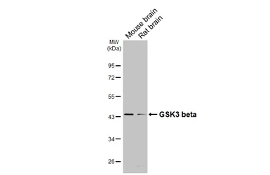 Anti-GSK3 beta antibody [C1C3] used in Western Blot (WB). GTX111192