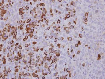 Anti-XIAP antibody used in IHC (Paraffin sections) (IHC-P). GTX111202