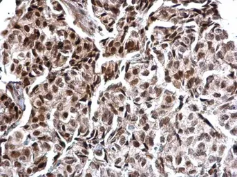 Anti-Calcineurin A antibody used in IHC (Paraffin sections) (IHC-P). GTX111207