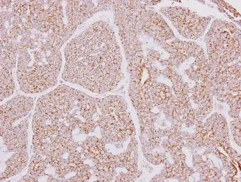 Anti-CARD10 antibody [N2C1], Internal used in IHC (Paraffin sections) (IHC-P). GTX111222