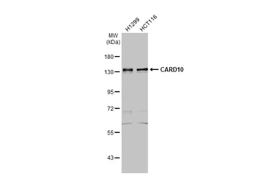 Anti-CARD10 antibody [N2C1], Internal used in Western Blot (WB). GTX111222