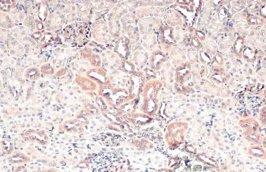 Anti-CARD10 antibody [N2C1], Internal used in IHC (Paraffin sections) (IHC-P). GTX111222