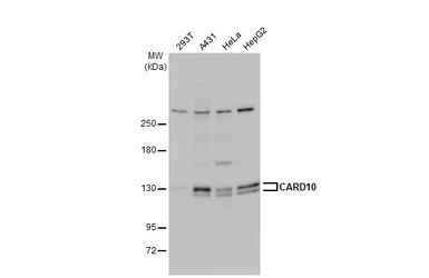 Anti-CARD10 antibody [N2C1], Internal used in Western Blot (WB). GTX111222