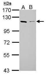 Anti-GAB1 antibody used in Western Blot (WB). GTX111253