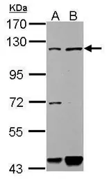 Anti-GAB1 antibody used in Western Blot (WB). GTX111253