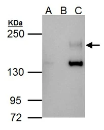 Anti-Her4 / ErbB4 antibody [C1C3] used in Immunoprecipitation (IP). GTX111276