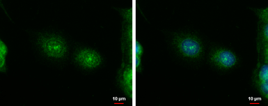 Anti-Her4 / ErbB4 antibody [C1C3] used in Immunocytochemistry/ Immunofluorescence (ICC/IF). GTX111276