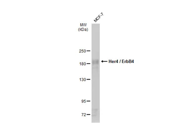 Anti-Her4 / ErbB4 antibody [C1C3] used in Western Blot (WB). GTX111276