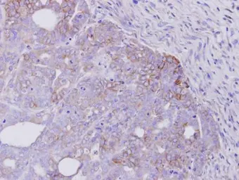 Anti-Her4 / ErbB4 antibody [C1C3] used in IHC (Paraffin sections) (IHC-P). GTX111276