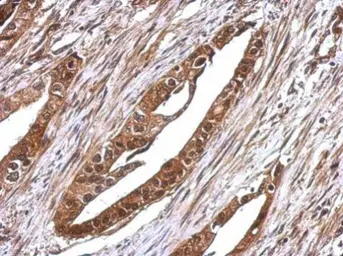 Anti-RUVBL1 antibody used in IHC (Paraffin sections) (IHC-P). GTX111294