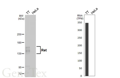 Anti-Ret antibody [N3C1], Internal used in Western Blot (WB). GTX111327